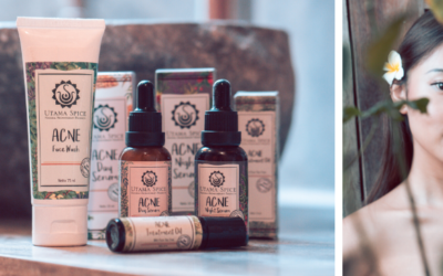 Skincare for Acne Prone Skin