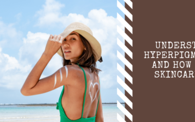 Understanding Hyperpigmentation And How Natural Skincare Helps