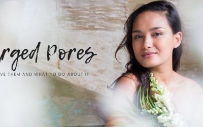Enlarged Pores: Why You Have Them And What To Do About It